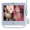 2.0 Mega Pixels,Build In Webcam 15 Inch Wifi MD1500A ,With SONY 1/4 CCD Dental Intraoral Camera System,LCD Monitor With holder,8GB U disk