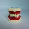 Jaw Model with Periodontal Disease