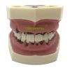 Peridontal Disease Model,Periodontal Jaw Model,28 Teeth,Soft Gum, Screw fixed, Without Articulator, Use For Scaling,Root Planting,Prophylactodontia,Hygienist Training And So On. 