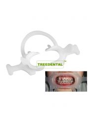 Dental Orthodotnic Materials Mouth Opener Multi-Function Cheek Retractor/Adjustable Retractor/3D Cheek Retractor,10 Bags