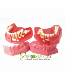 dental models