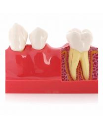 dental models for sale