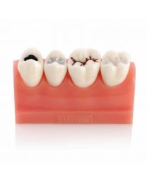 dental treatment model