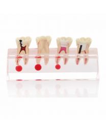 dental typodont models