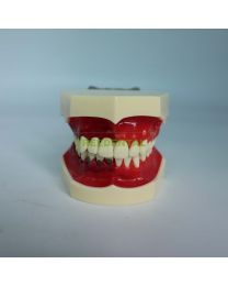 trimming dental study models