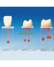 Endodontic Practice Model 1/4/6