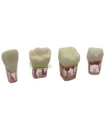 Endodontic Practice Model
