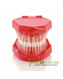 Standard Solf Gum with Removable Teeth Model-HH Teach Study 