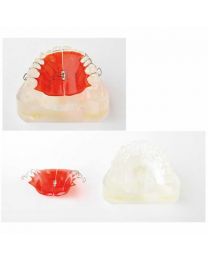 retainers dental