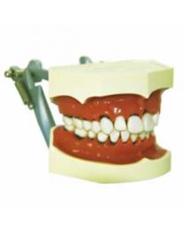 study model of teeth
