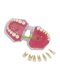 Standard Solf Gum with Removable Teeth Model Teach Study 