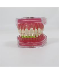 Standard Solf Gum with Removable Teeth Model Teach Study 