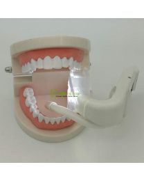Dental Intraoral Light Mouth Prop Support Bite Block for Saliva Suction Tube Tip