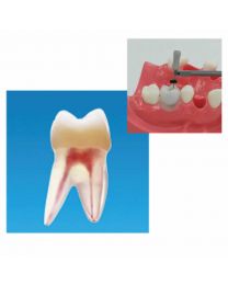 typodont teeth price