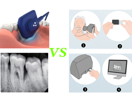 Two Solutions For Dental X-ray Imaging Diagnosis - DR Sensor Imaging Vs CR Image Plate Imaging