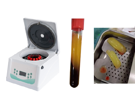 Plasma Blood Separator-An indispensable growth factor extraction equipment in the field of oral implantation！