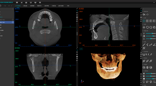 CE Approved High Grade Medical Radiography Dentaire 2D 3D Dental CBCT Machine Panoramic Machine X-Ray Scanner 