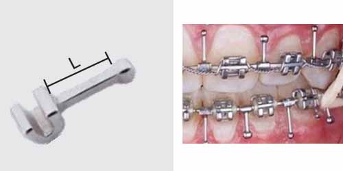 Orthodontic Inside Oral Cavity,Crimpable Hook Sliding Ball Crimpable Hook，Long  Curved Crimpable Hook,Stop Locks With Hook