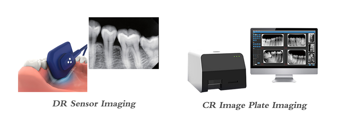 Two Solutions For Dental X-ray Imaging Diagnosis - DR Sensor Imaging Vs CR Image Plate Imaging