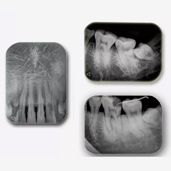 Dental Equipment Unit Digital CR System Intra Oral Imaging Plate Scanner X- Ray Dental Film Viewer Digitizer Scanner