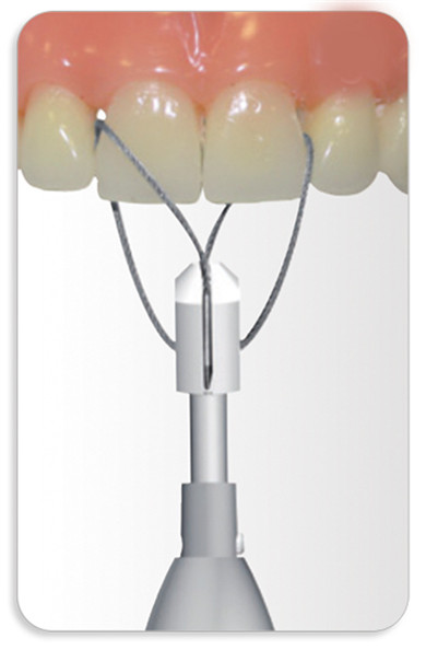 Dental Automatic Crown And Bridge Remover