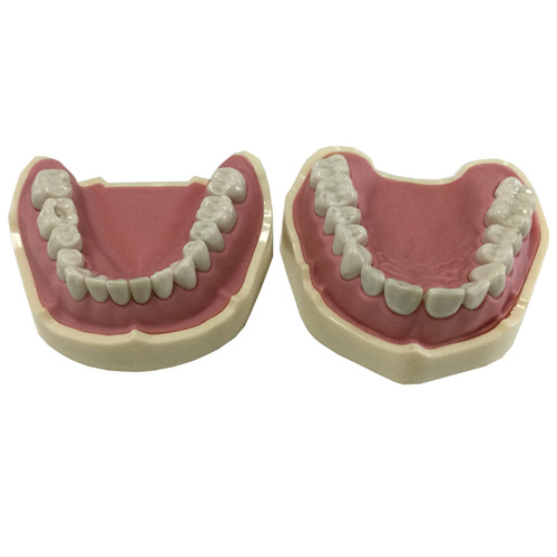 Study Model 28 teeth