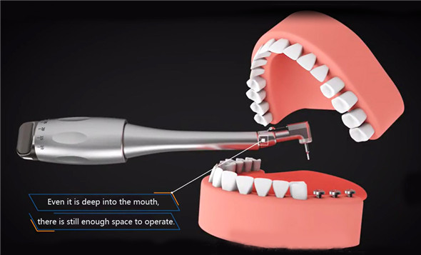 Dental Implant Torque Control